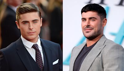 Zac Efron’s Face Before & After Surgery—The Truth Behind What Really Happened to His Jaw