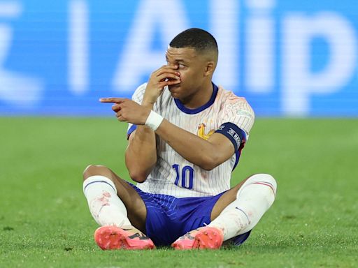 French players and football federation hopeful Mbappe can play through broken nose