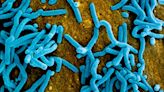 What is the Marburg virus? WHO confirms outbreak of the deadly viral disease in Equatorial Guinea and Tanzania