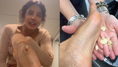 Priyanka Chopra tries Indian ‘nuskha’ of rubbing garlic on feet after suffering injuries on film set in Australia. See pics, videos