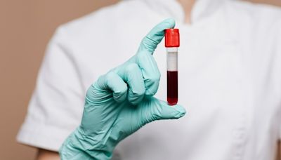 Novo exame de sangue prevê câncer, insuficiência cardíaca e 65 outras doenças até 10 anos antes do diagnóstico
