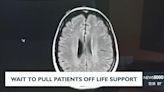 Study suggests patients with traumatic brain injury should not be taken off of life support so quickly