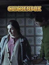 Chickenpox