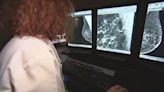 Women should have mammograms earlier in life, experts say