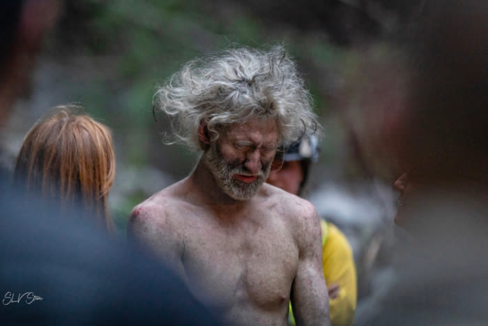 Lost Hiker Survived for 10 Days in Santa Cruz Mountains: ‘It Was an Awesome Experience’