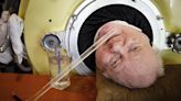 Man who used an iron lung for decades after contracting polio dies at 78