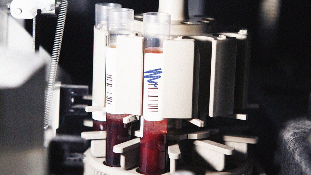 Protein 'signatures' in a single blood test could help detect over 60 conditions