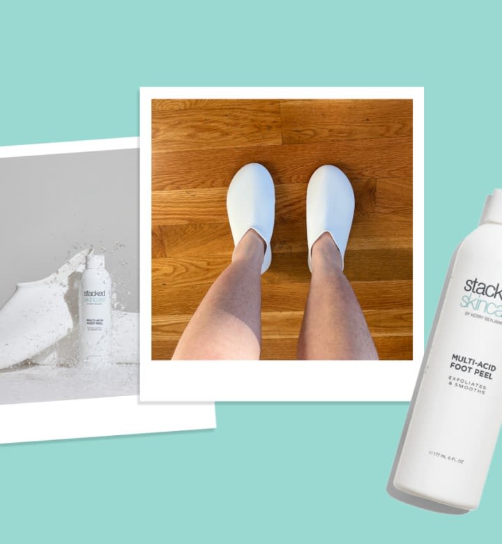 My Dry Feet Were Grossing Me Out, So I Tried Stacked Skincare’s Foot Peel Treatment…And the Results Were Shocking