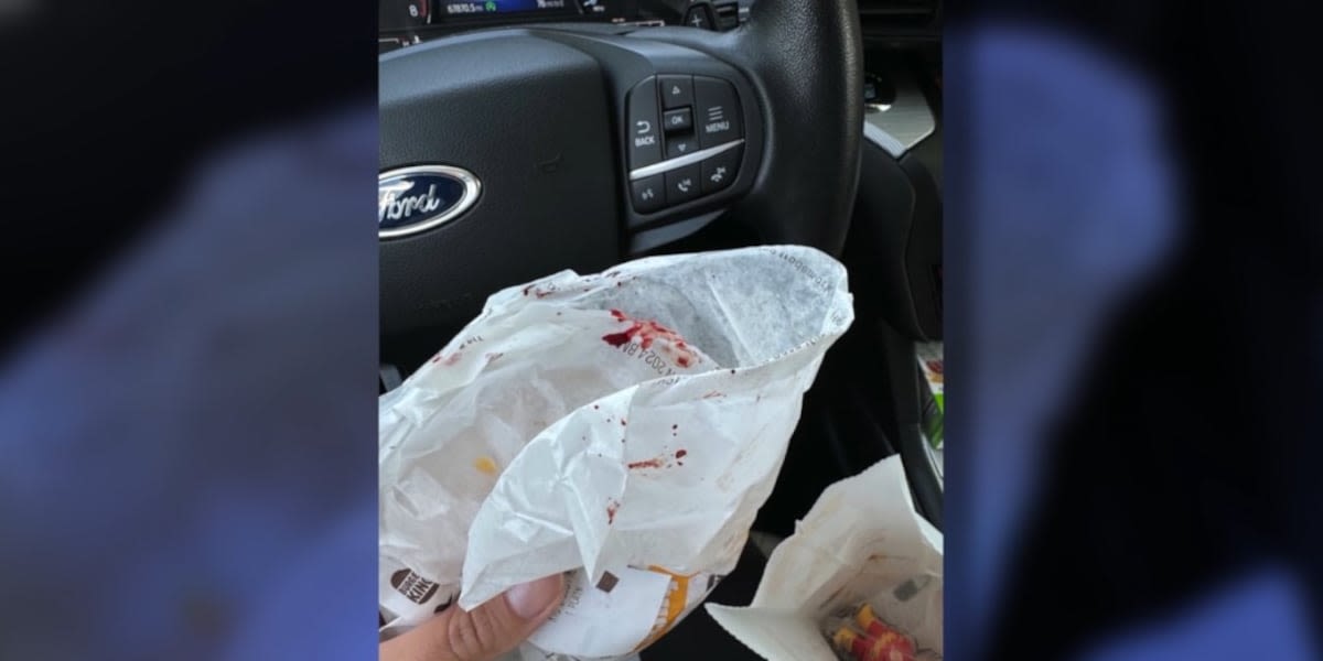 NY mom says she found blood ‘all over’ her 4-year-old daughter’s Burger King meal