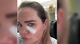 Nurse knew it was serious after spotting unusual spot under her eye