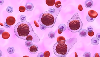 GSK’s Omjjara gains approval in Japan for myelofibrosis treatment