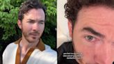 Kevin Jonas, de los Jonas Brothers es operado; uno de sus lunares era un tumor maligno