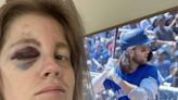 Fan beaned at Jays game to get ball signed by Bo Bichette