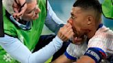 Mbappé suffers facial injury in France's 1-0 win against Austria at Euro 2024