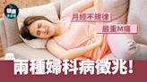 經痛｜月經不規律、嚴重M痛 兩種婦科病徵兆