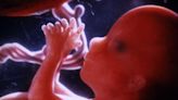 Tiny organs grown from amniotic fluid could reveal problems before birth