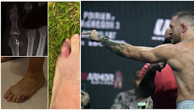 Conor McGregor claims ‘eye-opening’ treatment on broken toe has made it WORSE