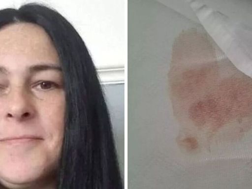 Mum's Blackpool holiday nightmare after 'blood stains found on hotel sheets'