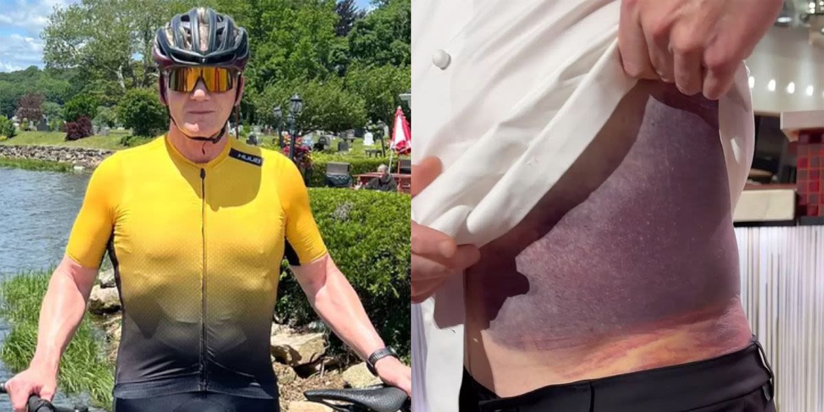 Gordon Ramsay Says He's Lucky To Be Alive After Terrifying Bike Accident