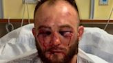 Una estrella de UFC terminó con la cara desfigurada tras perder por nocaut: la comparación de su rostro que se hizo viral