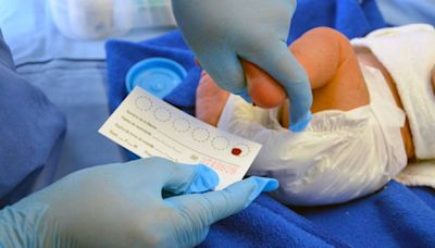 Cofece investiga prácticas monopólicas en pruebas de tamiz para recién nacidos