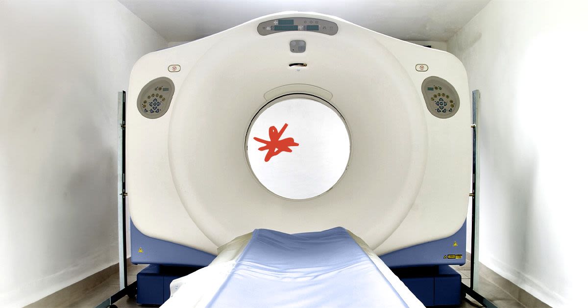 Can an MRI detect cancer anywhere in the body?