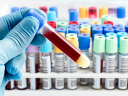 FDA approves new blood test to detect colon cancer