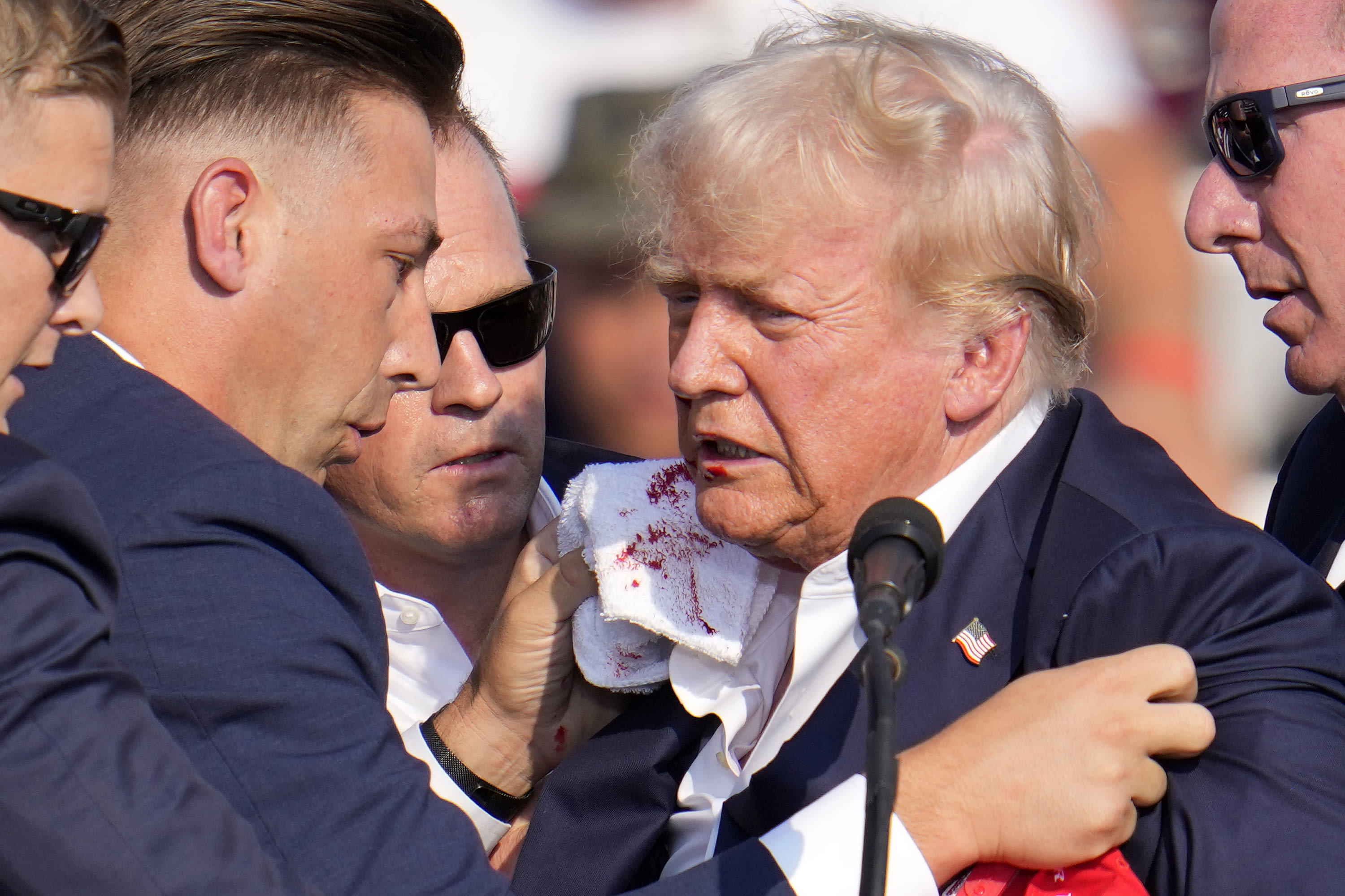 Photo is said to show Trump’s ear with no damage on Monday after shooting. It’s from 2022