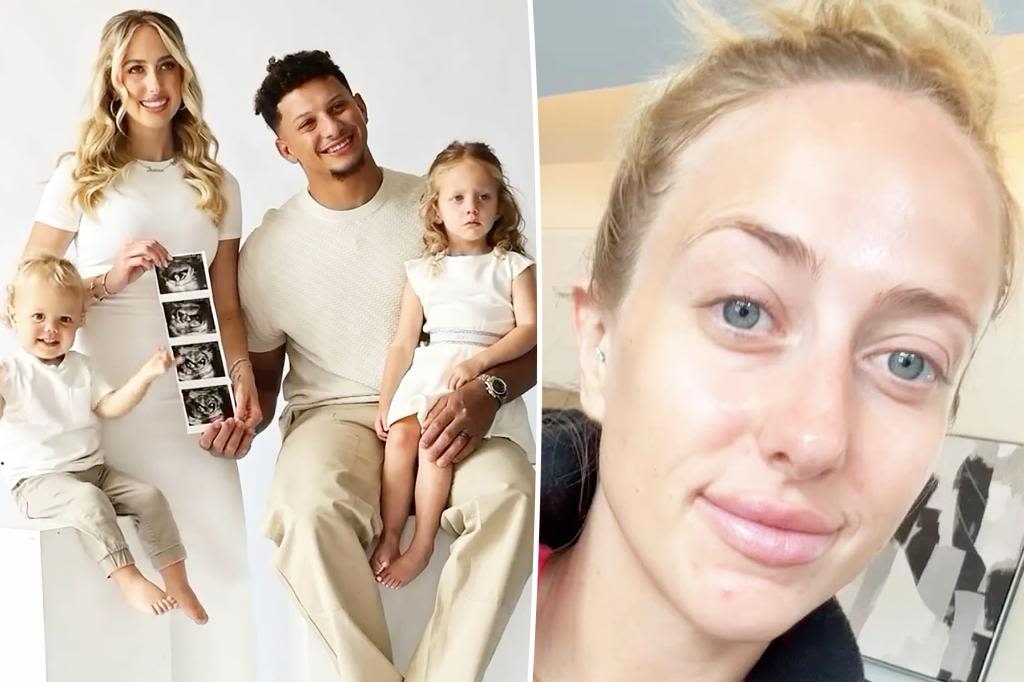 Brittany Mahomes gets real about skin struggles during ‘hardest’ pregnancy yet