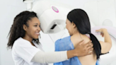 It’s official: Women Should Be Screened For Breast Cancer Starting at 40, Ten Years Earlier Than Previously Advised