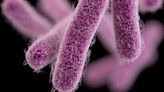 Shigella outbreak hits Calgary shelters and encampments, sending 16 to hospital | CBC News