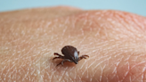 Rocky Mountain spotted fever: What are the symptoms to watch for?