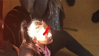 Metro CDMX hoy: Mujer sufre aparatoso accidente en Línea 12