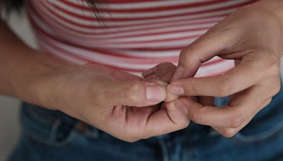 Doctor warns of little-known nail symptom that could be sign of deadly disease