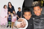 What is vitiligo? All about the disease affecting Kim Kardashian’s son