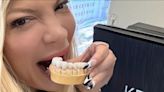 Tori Spelling got veneers after letting teeth turn to ‘s***’ in her 40s