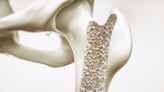 Gran avance frente a la osteoporosis: desarrollan un mecanismo capaz generar más células