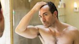 A Plastic Surgeon Shared an Easy Way to Tell if Your Hairline Is Receding