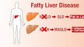 Medical Moment: $1 billion people in the US are living with some form of liver disease