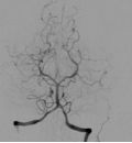 Angiography