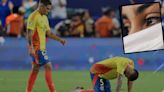 Esto es lo que debe tener en cuenta para pasar la tusa pospartido tras la derrota de la selección Colombia