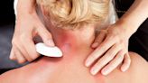 Can gua sha relieve your pain? Traditional medicine’s ‘best kept secret’