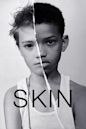 Skin (2018 short film)