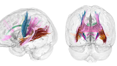 Scans show changes in brain during pregnancy