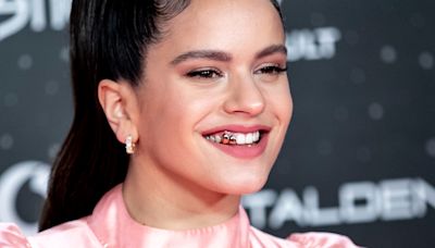 La tendencia de los dientes metálicos a la que se suma Rihanna: una moda pasajera con efectos secundarios