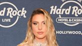 Influencer Lele Pons opens up about ‘really bad’ pit bull bite she suffered while rescuing her dog