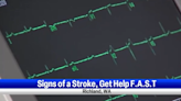 A Kadlec Cardiothoracic surgeon talks different kinds of strokes and how they're treated