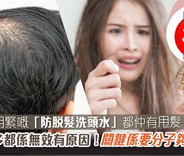 用緊嘅「防脫髮洗頭水」都仲有甩髮？試咁多都係無效有原因！