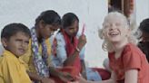 India’s Manohara Evolves From Award-Winning Child Actor to Director of Shanghai-Selected Film on Albinism ‘Bird of a Different Feather’