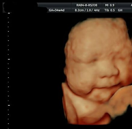 a-little-insight-3d-4d-5d-ultrasound-vacaville- - Yahoo ...